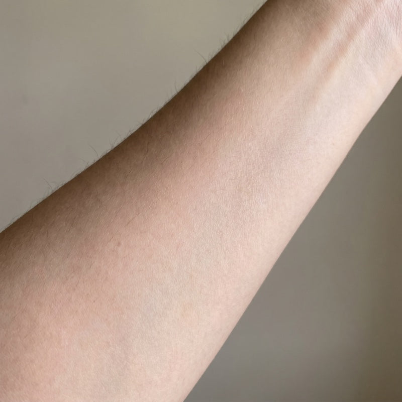 Same forearm, clear calm skin at week 14